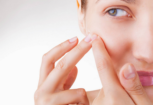 Tìm hiểu về mụn đầu đen và mụn đầu trắng