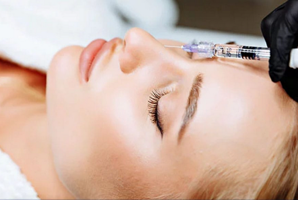 Tiêu filler duy trì được bao lâu