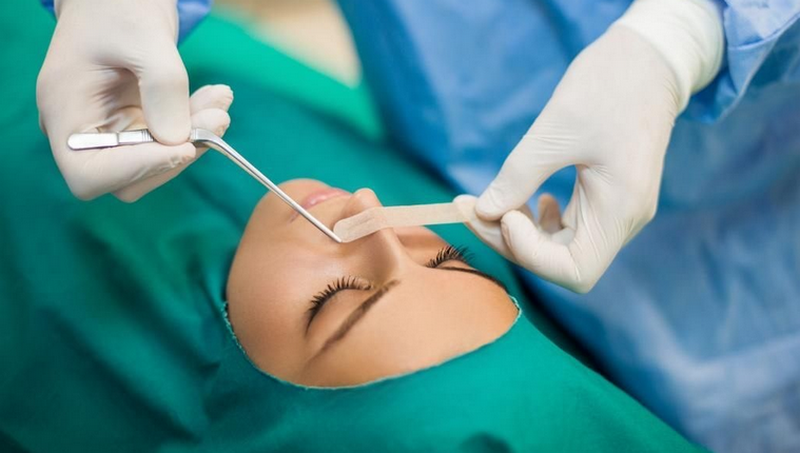 So sánh tiêm filler và phẫu thuật thẩm mỹ