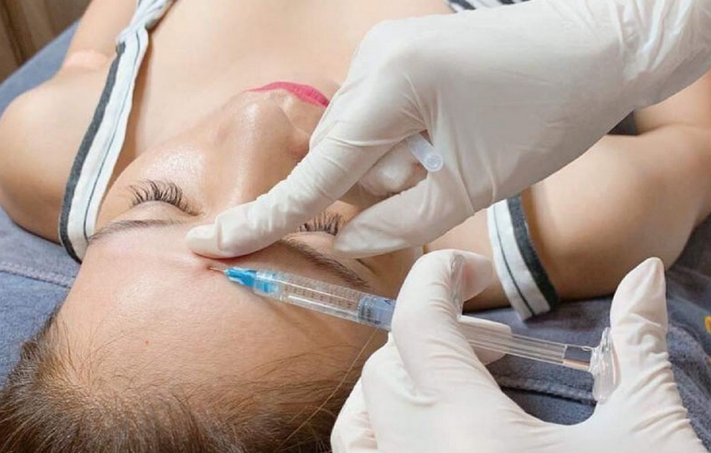 Tiêm Filler có ảnh hưởng đến sức khỏe lâu dài không?