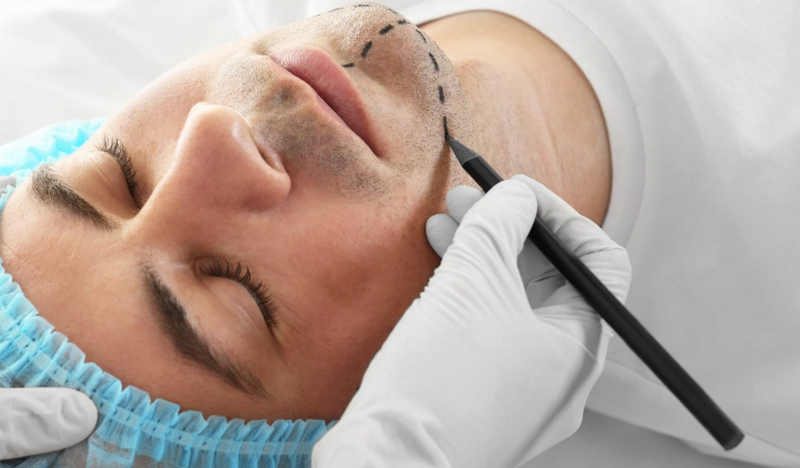 Tiêm filler cho nam giới: Xu hướng thẩm mỹ mới