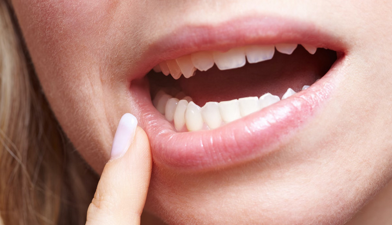 Không tác động ngoại lực lên môi, không nặn mụn li ti ở môi