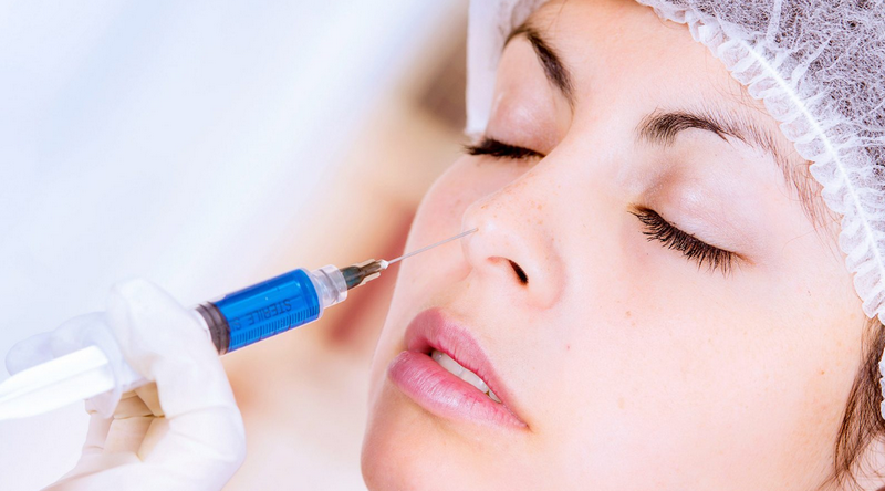 Tiêm filler là giải pháp nâng mũi không phẫu thuật cho hiệu quả tức thì và sự tự nhiên