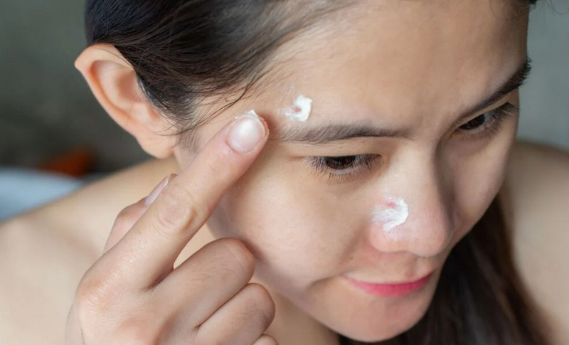 Cách làm xẹp mụn sưng đỏ sau 1 đêm