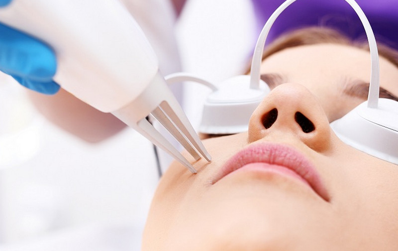 Mụn cơm ở mặt: Nguyên nhân, cách nhận biết và điều trị hiệu quả