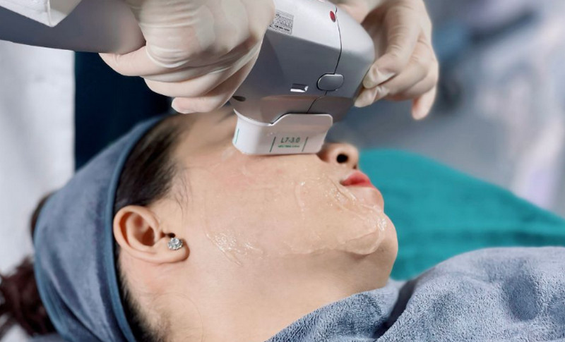 Khách hàng nên chọn cơ sở y tế có thiết bị nâng cơ HIFU đạt chuẩn để đảm bảo an toàn