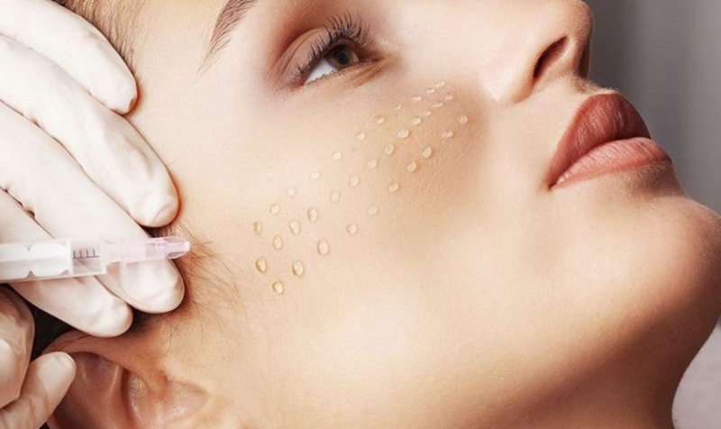 Tiêm meso trị mụn được không, giá bao nhiêu?