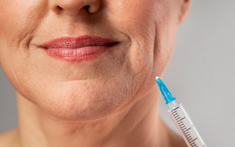 Các loại Filler phổ biến và cách chọn lựa