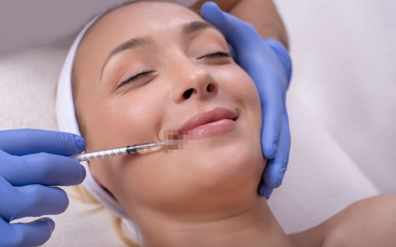 Tiêm filler cằm bao lâu thì vào form, giữ được trong bao lâu?