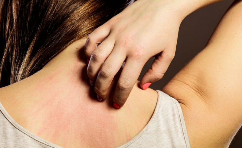 Bị ngứa người không rõ nguyên nhân và giải pháp điều trị