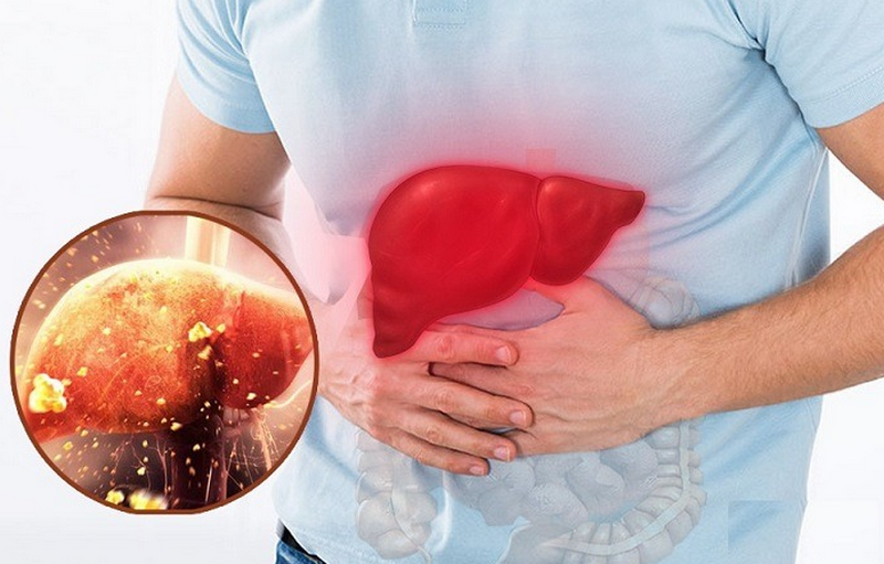 Nóng gan nổi mẩn ngứa phải làm sao? 