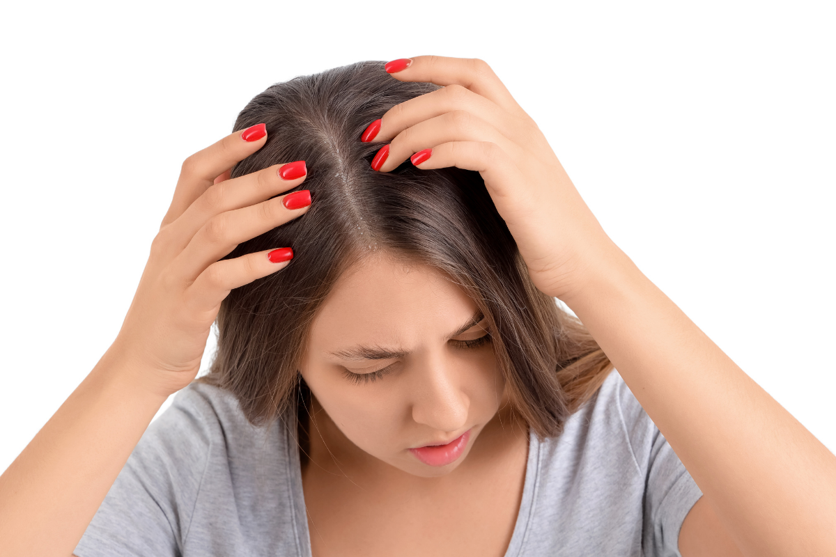 Viêm da đầu là gì? Cảnh báo rụng tóc vĩnh viễn và cách xử lý hiệu quả