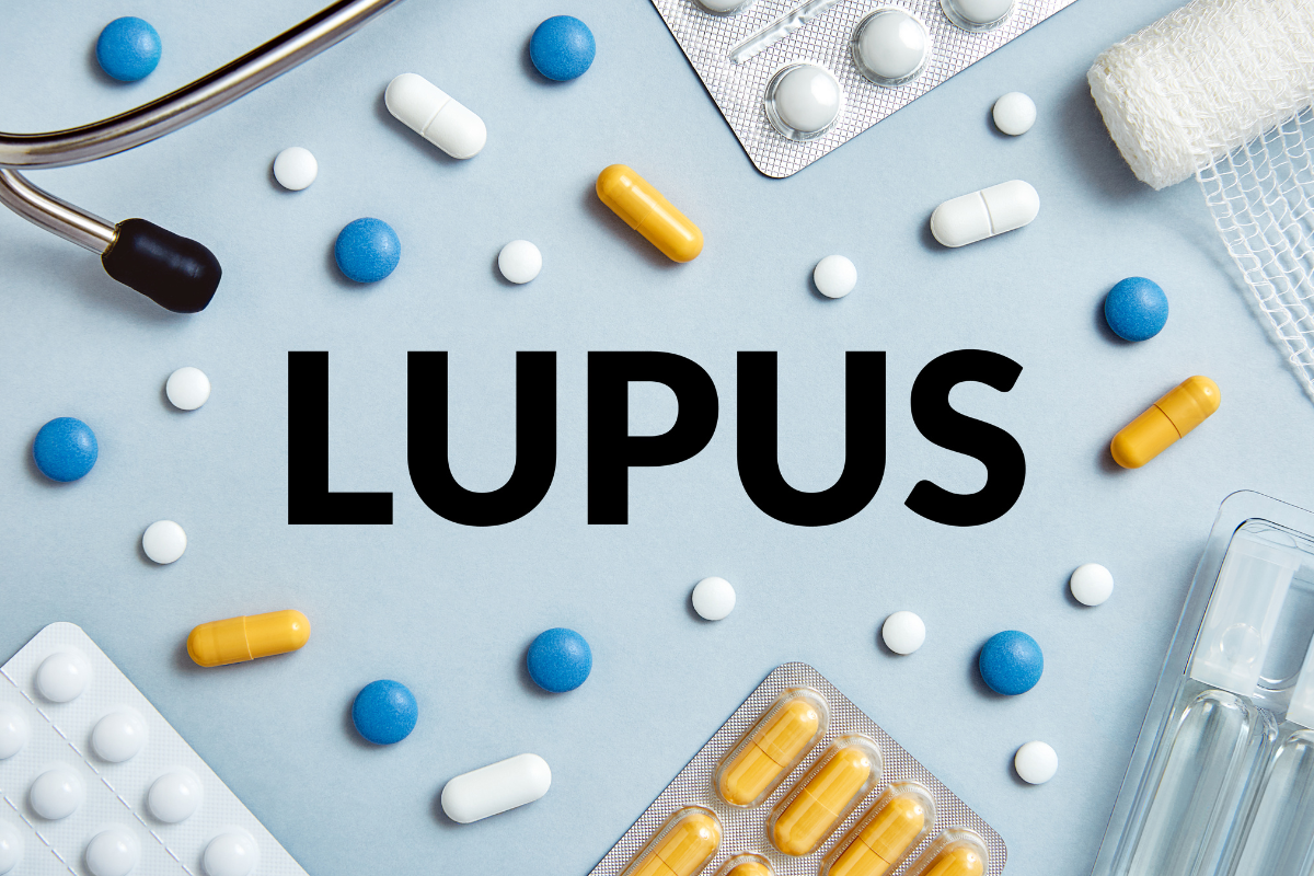9 điều cần biết về lupus ban đỏ hệ thống để sống chung với bệnh hiệu quả