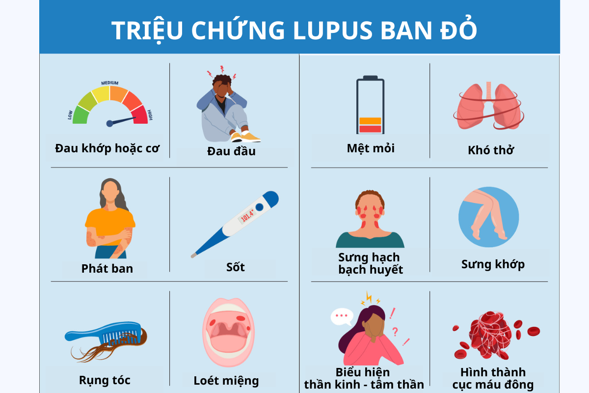 Triệu chứng lupus ban đỏ
