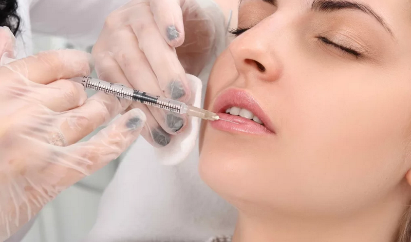 Những dáng môi tiêm filler đẹp được chị em yêu thích nhất