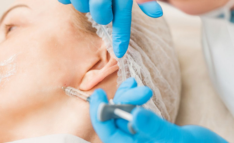 Tiêm botox gọn hàm giữ được bao lâu? Lưu ý cần thiết