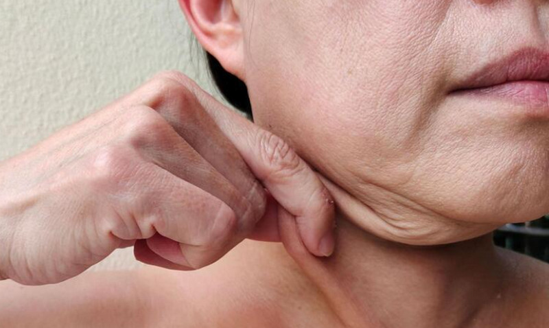 Tiêm botox có hại không? Có nên tiêm không?