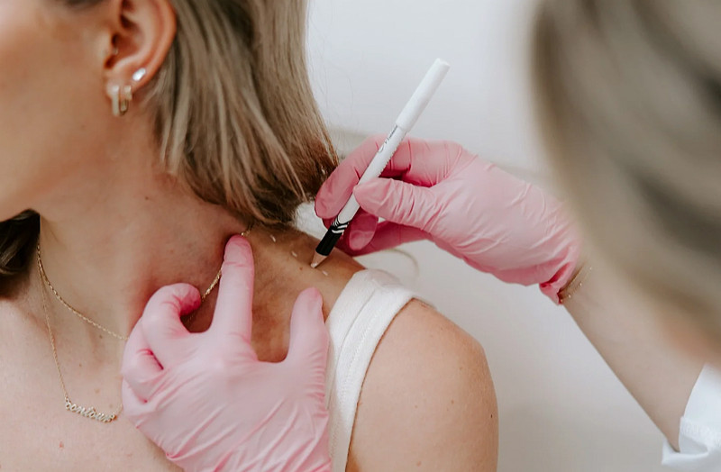 Tiêm botox có hại không? Có nên tiêm không?