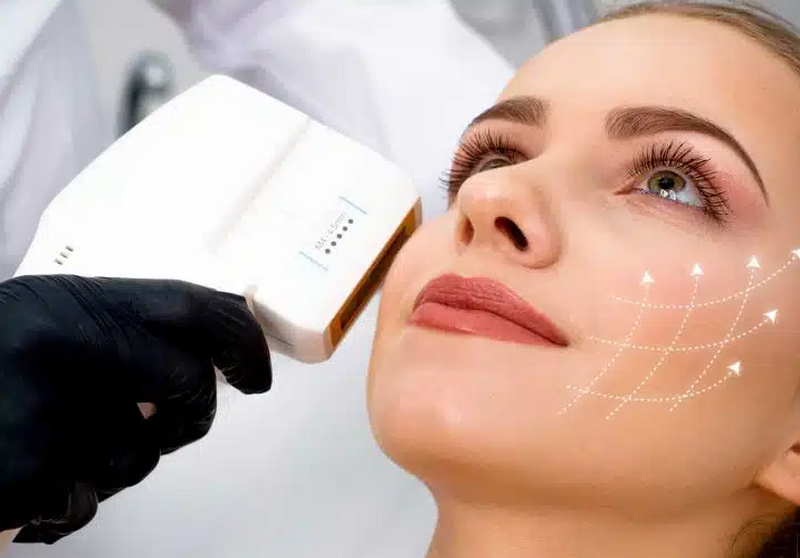 Công nghệ HIFU: Ưu, nhược điểm và những vấn đề cần chú ý