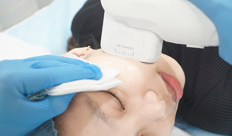 Công nghệ HIFU: Ưu, nhược điểm và những vấn đề cần chú ý