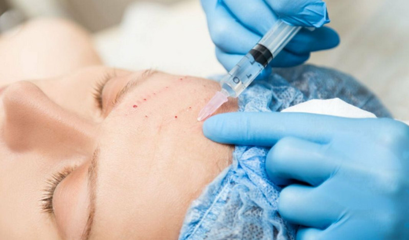 Trẻ hóa da mặt bằng công nghệ cao và những lưu ý quan trọng