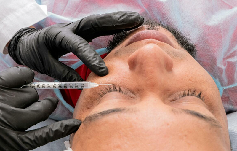 Tiêm tan filler bao lâu thì hết sưng? 5 cách giảm sưng hiệu quả