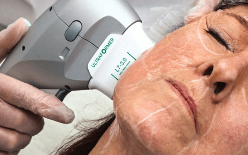 Nâng cơ trẻ hóa không phẫu thuật là gì? Các công nghệ phổ biến