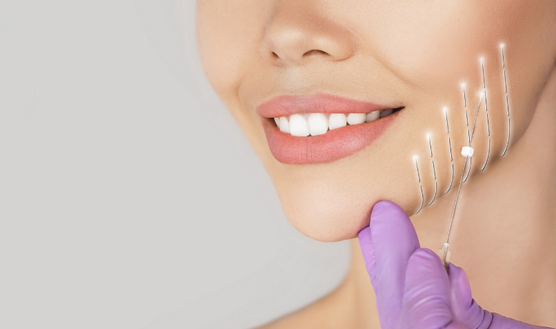 Nâng cơ trẻ hóa da mặt: Công nghệ nào hiệu quả, ưu nhược điểm