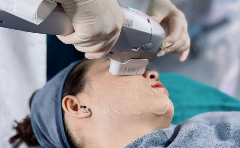 Nâng cơ trẻ hoá không phẫu thuật là gì? Các công nghệ phổ biến