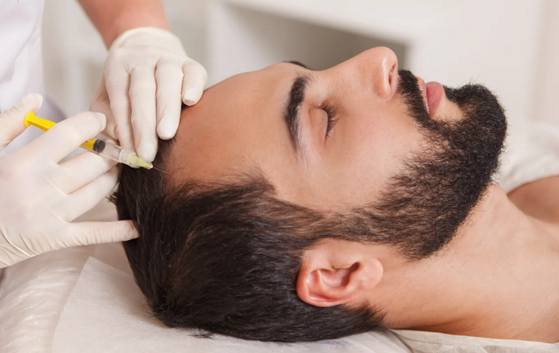 Mesotherapy là gì? Các phương pháp nổi bật