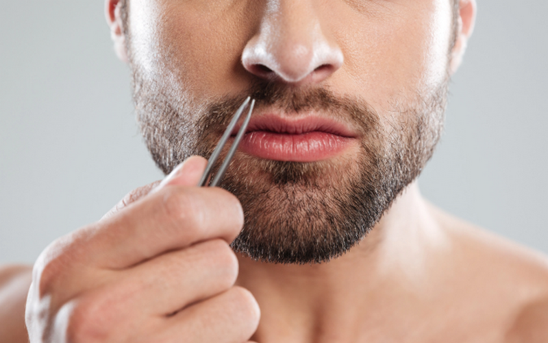 Triệt lông là gì? Có vĩnh viễn không? Cách triệt sạch lông an toàn