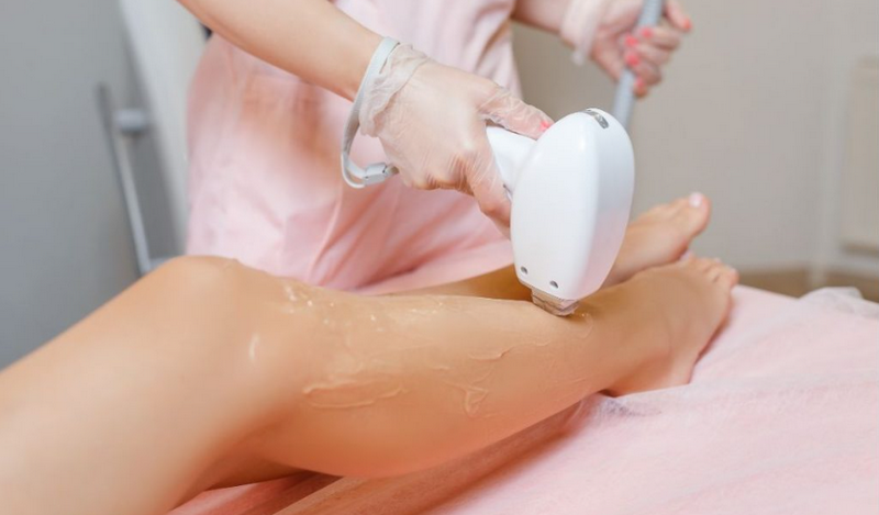 Có nên triệt lông chân vĩnh viễn? Ưu nhược điểm từng phương pháp
