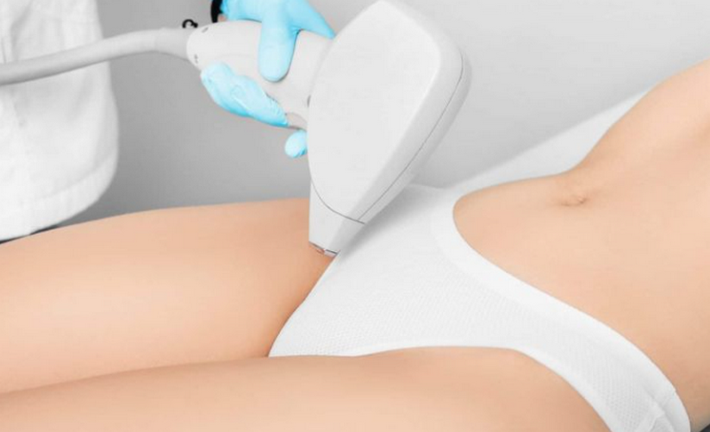 Tẩy lông vùng kín: Chi phí, công nghệ & cách chọn địa chỉ uy tín