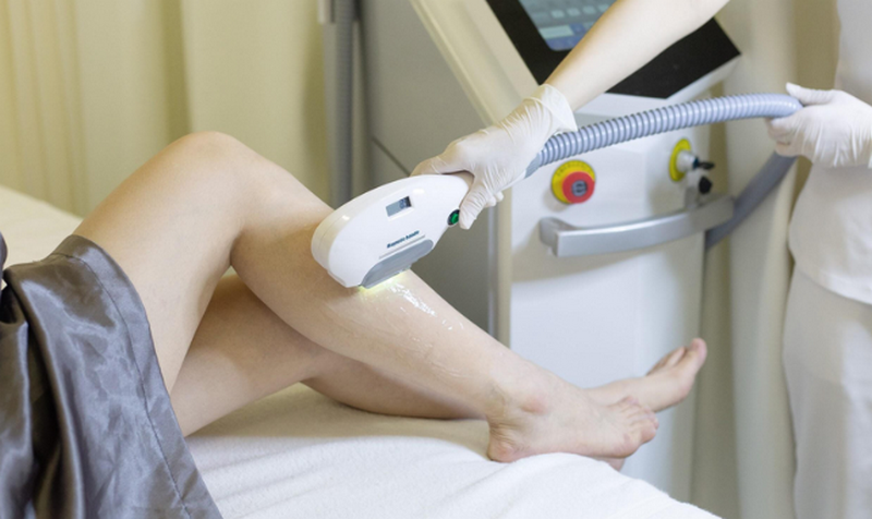 Triệt lông vĩnh viễn: Nguyên lý, công nghệ & hiệu quả thực tế