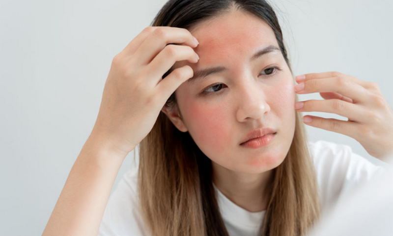 Meso Botox là gì? Tác dụng và những lưu ý cần thiết