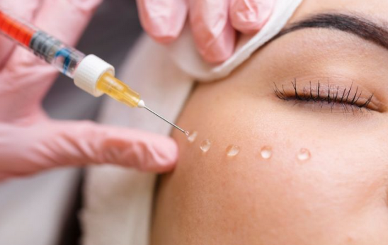 Meso Botox là gì? Tác dụng và những lưu ý cần thiết