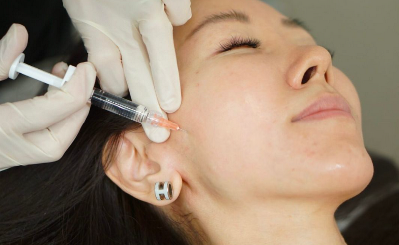 Kỹ thuật tiêm BAP 5 điểm là gì? Có tác dụng như thế nào?