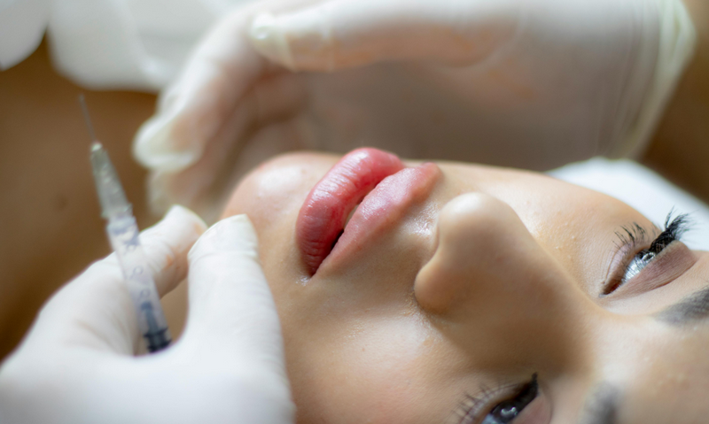 Tiêm filler có hại về sau không? Tác dụng phụ thường gặp nhất