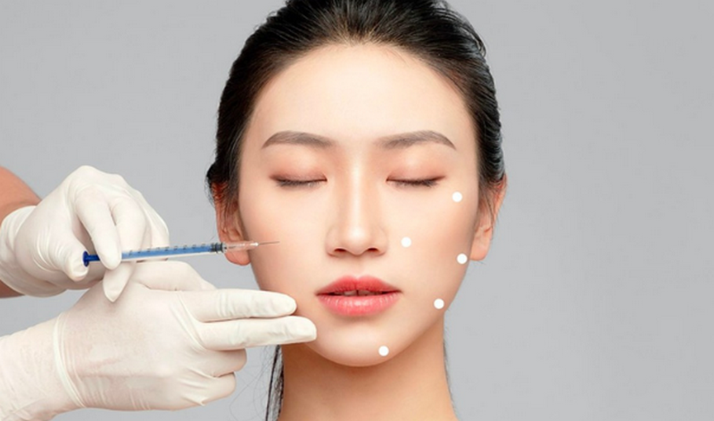 Tiêm profhilo của nước nào, giá bao nhiêu tiền?
