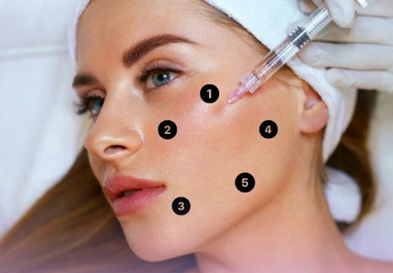 Tiêm BAP giá bao nhiêu tiền, giữ được bao lâu?
