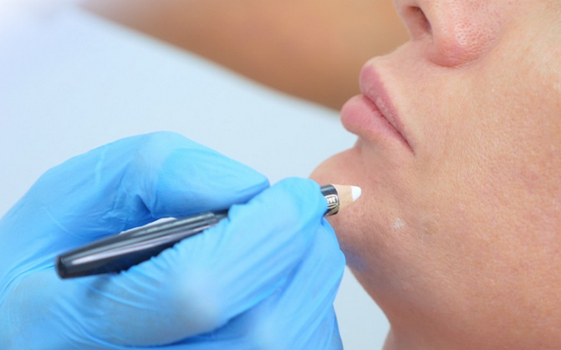 Tác hại của tiêm BAP là gì? Có nên tiêm không?