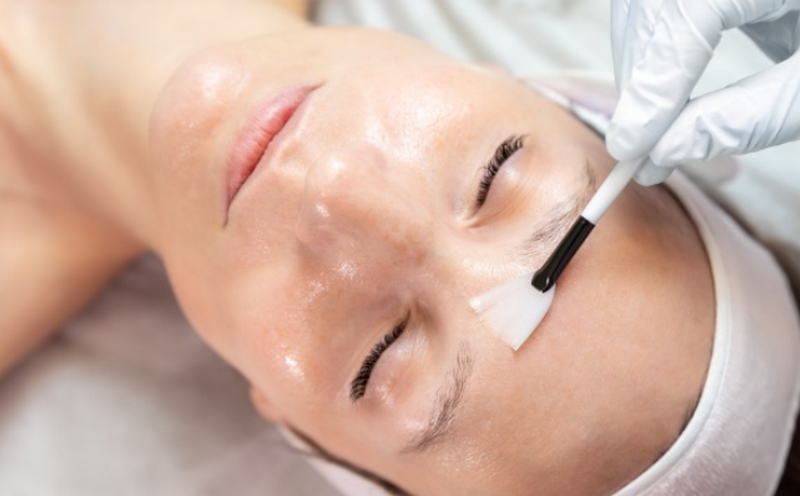 Bắn laser trị thâm được không? Chi phí bao nhiêu tiền?