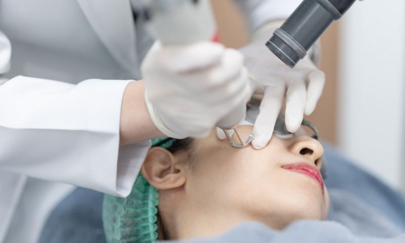 Cách chăm sóc da sau khi bắn laser trị nám