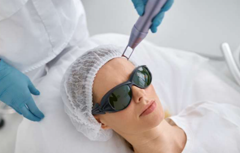 Laser Toning là gì? Cơ chế, công dụng và những ai nên điều trị?