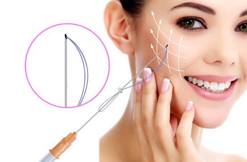 Nâng cơ mặt bằng phương pháp nào tốt nhất?