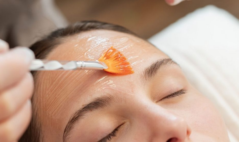 Chăm sóc da sau peel: Các bước phục hồi và những điều cần tránh