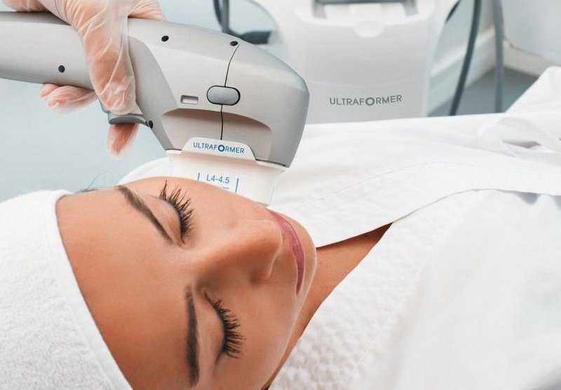 Công nghệ Ultherapy và ứng dụng nổi bật trong thẩm mỹ không xâm lấn