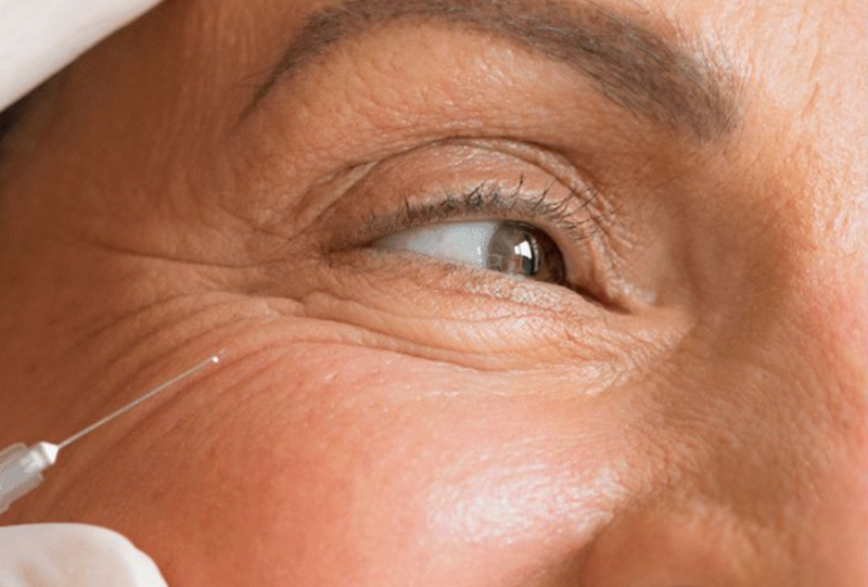 Rejuran là gì? Những điều bạn cần biết trước khi sử dụng