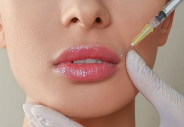 Tiêm môi: Công dụng, quy trình & điều cần biết trước khi thực hiện