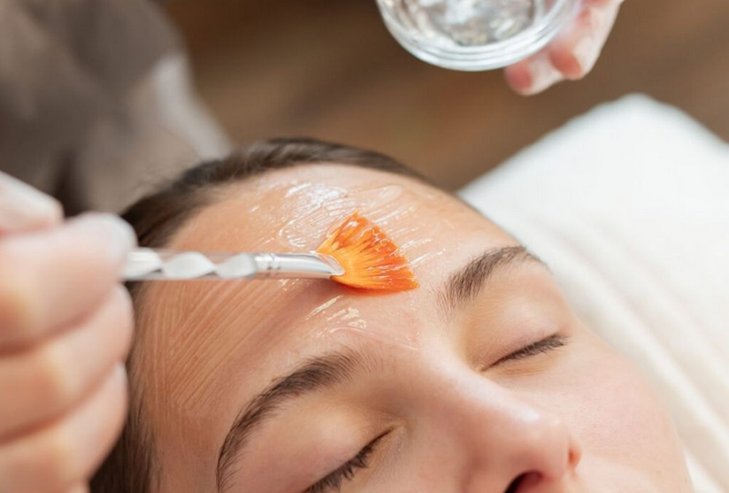 Có nên peel da không? Hiệu quả? Ai nên và không nên thực hiện?